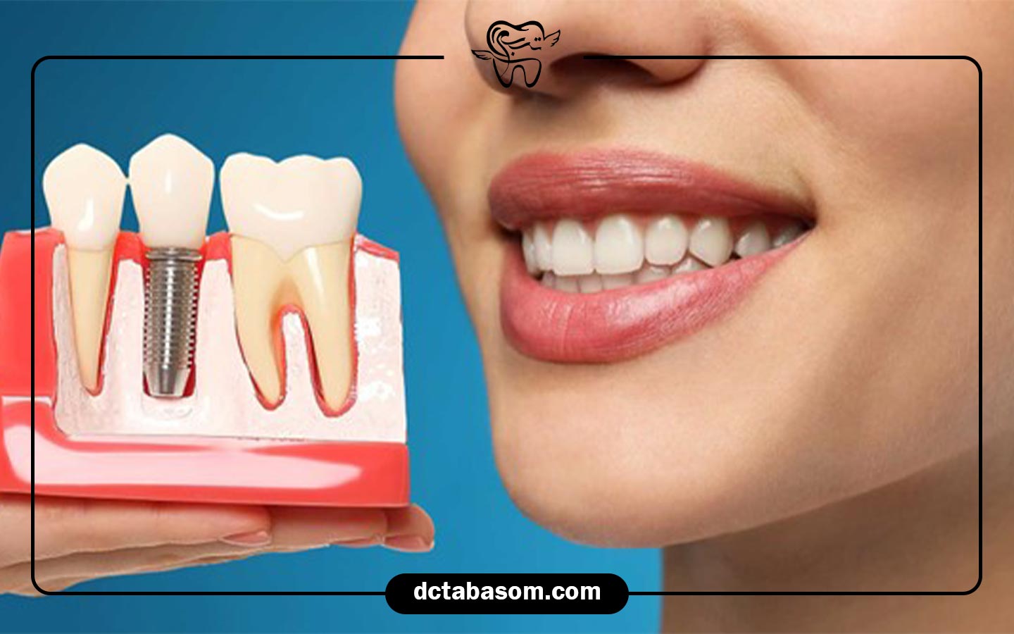 شرایط پرداخت اقساطی چگونه است