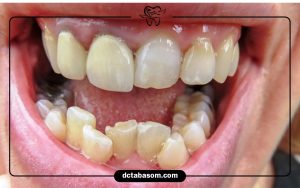 چگونه بدون فشار مالی درمان دندان خود را شروع کنیم