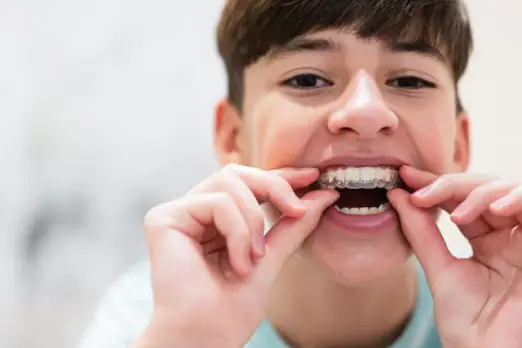 ارتودنسی ثابت برای کودکان در غرب تهران