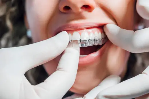 ارتودنسی کودکان با پلاک شفاف در غرب تهران