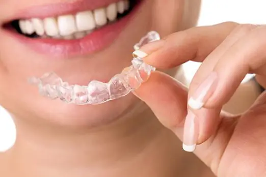 اردتودنسی شفاف اینویزیلاین برای کودکان در غرب تهران