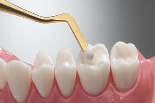 ترمیم دندان در غرب تهران