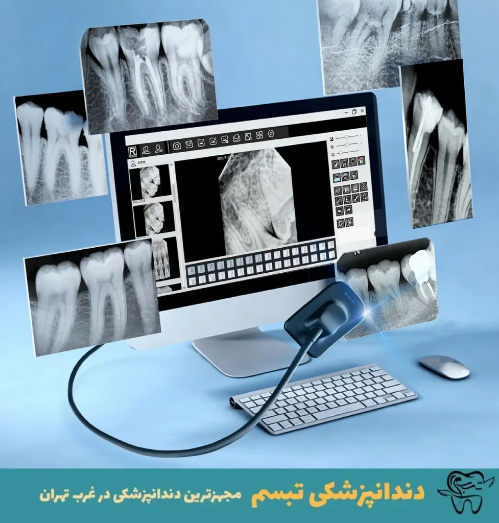 عکسبرداری دیجیتال دندان در زیبا شهر